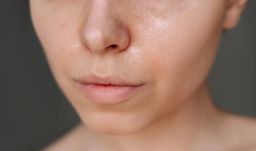 VISIA® Skin Analysis at ExcelLife Integrative Care
